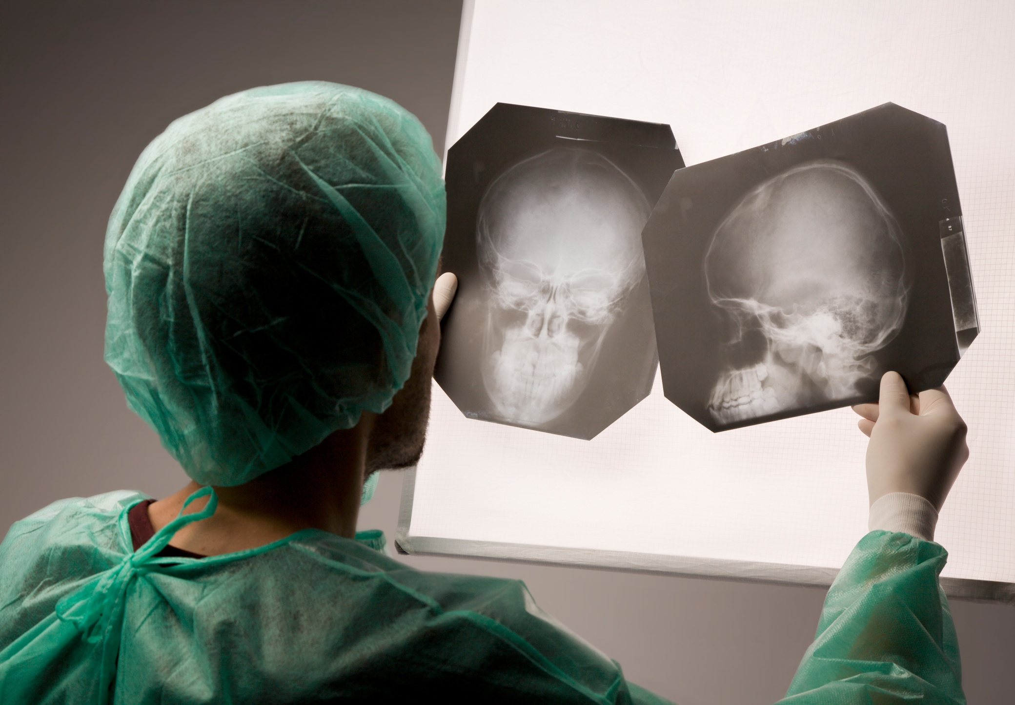 personal injury attorney with doctor examining xray